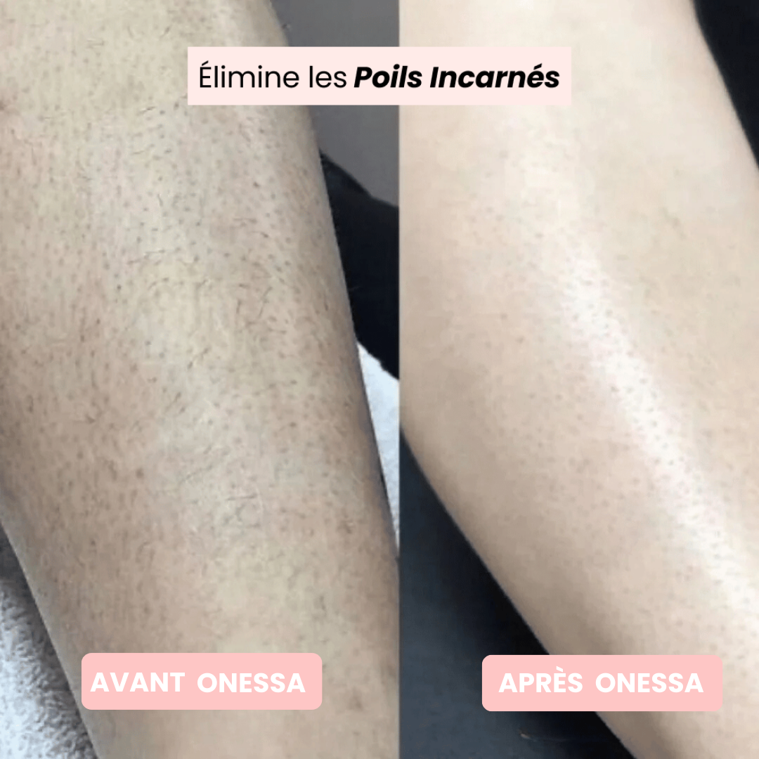 Rasoir Onessa + Gant Exfoliant Offert