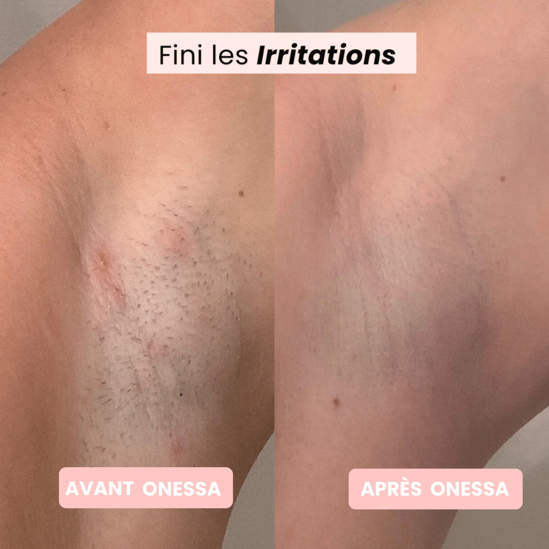 Rasoir Onessa + Gant Exfoliant Offert